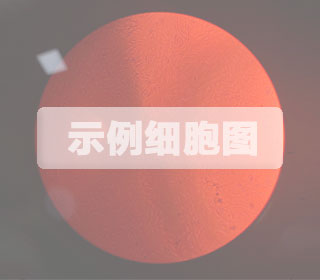 SB-1小鼠膽管癌